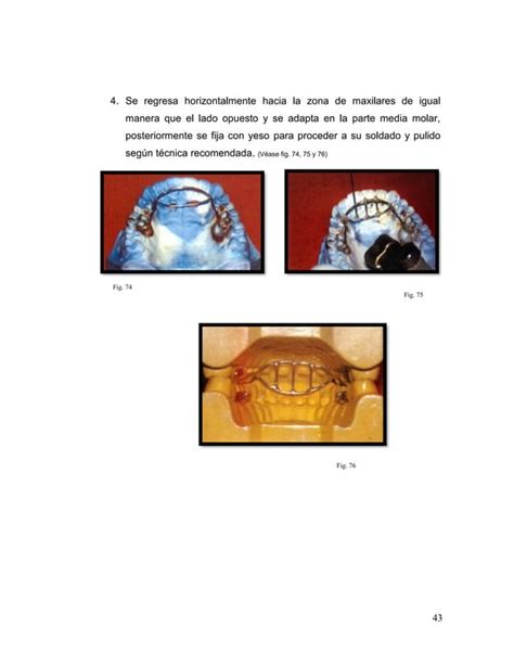 Manual De Ortodoncia Por Andrea Berrios Pdf