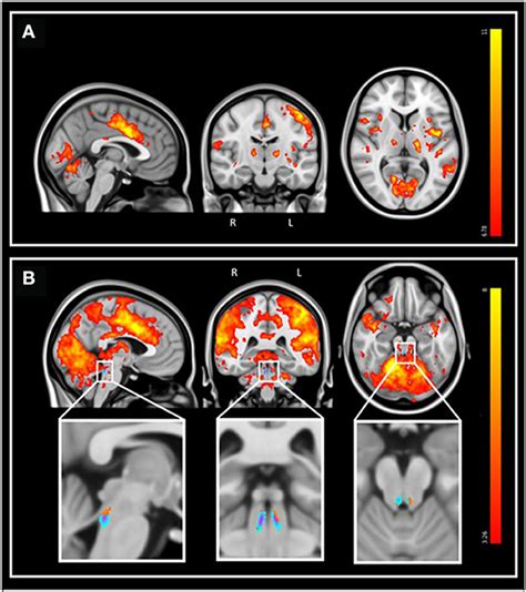 Frontiers Structural And Functional Characterization Of The Locus