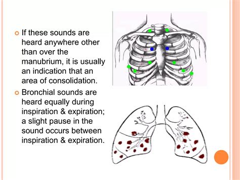 Auscultation | PPT