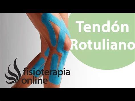 Kinesiotape Para La Condropatia O Condromalacia Rotuliana Youtube