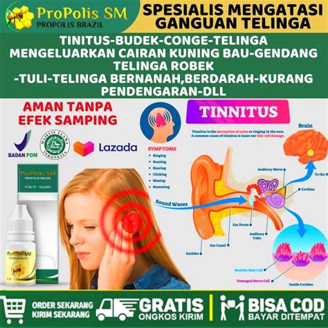 Obat Tinitus Tinnitus Telinga Gemuruh Dengung Desis Detak Raung