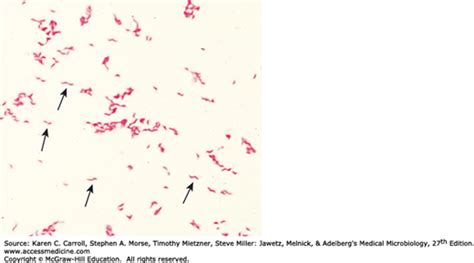 Vibrio Campylobacter And Helicobacter Basicmedical Key