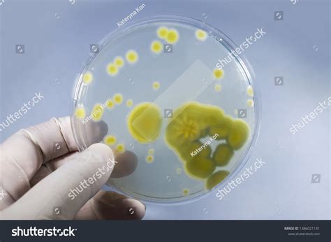 Colonies Of Penicillium Fungi Grown On Sabouraud Royalty Free Stock