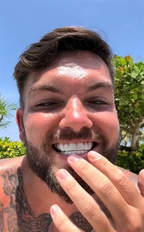 Itv Love Island Star In Furious Rant As His £6k Turkey Teeth Are