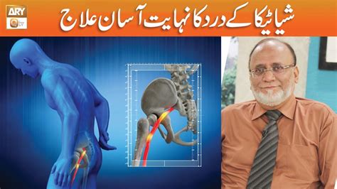 Sciatica Pain Kamar Dard Ka Asan Ilaj Hakeem Syed Abdul Basit YouTube