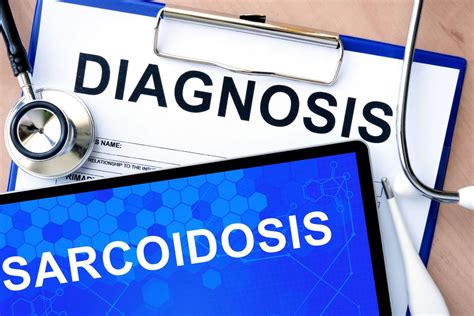 Sarcoidosis with Ocular and Pulmonary Involvement