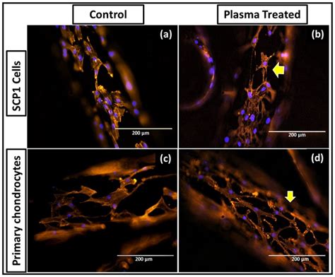 Effect Of Plasma Treatment On Cell Spreading Actin Phalloidin Alexa