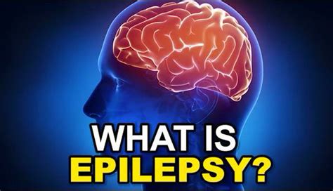 My Sons Brain Was Split In Two To Try And Cure His Epilepsy Wales