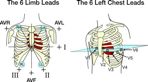 Precordial Leads Ecg Placement