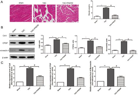 Paeonol Inhibited Fibrosis And Reduced The Expression Of Col I Ctgf