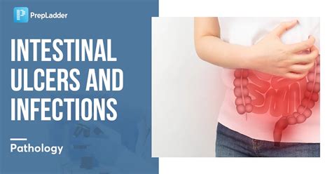 Intestinal Ulcers And Infections