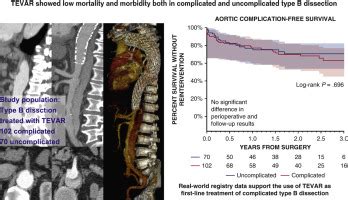 Endovascular Treatment Of Complicated Versus Uncomplicated Acute Type B