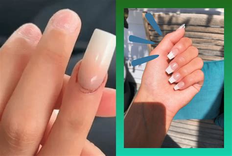 Broken Acrylic Nail Throbbing Skincell Org