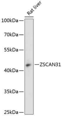 Znf Antibody Azide And Bsa Free Nbp Bio Techne