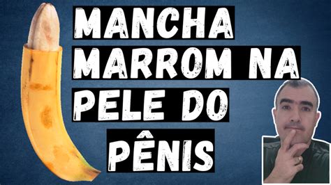 Mancha Marrom na Pele do Pênis Dr Lucas Felipe Gomes Urologista