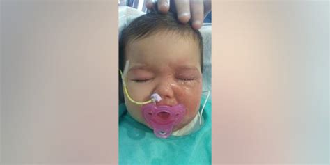 Oklahoma Infant Suffers Second Degree Burns After Pulling Slow Cooker