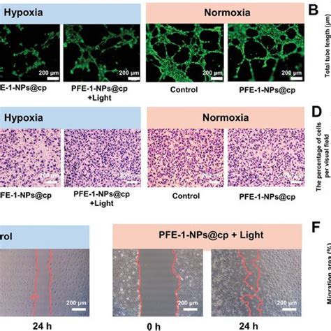 In Vitro Activity Evaluation Of PFE1NPs Cp A Representative Images