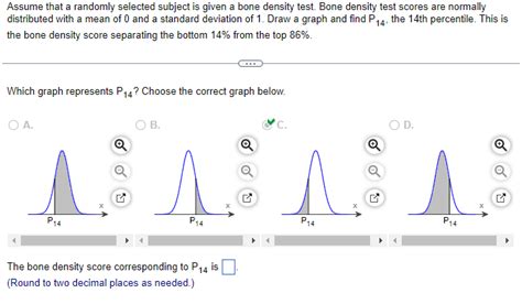 Assume That A Randomly Selected Subject Is Given A Bone Density