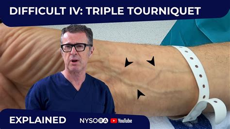 Difficult Intravenous Iv Cannulation 2 Triple Tourniquet Technique