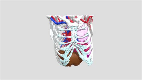 Case 1 Postoperative 3d Model By Chair Digital Anatomy [1796fd4] Sketchfab