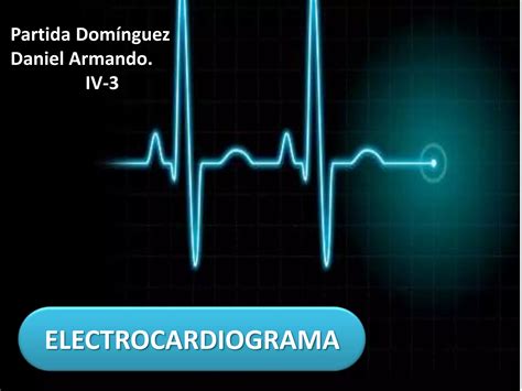 Electrocardiograma PPT Descarga Gratuita