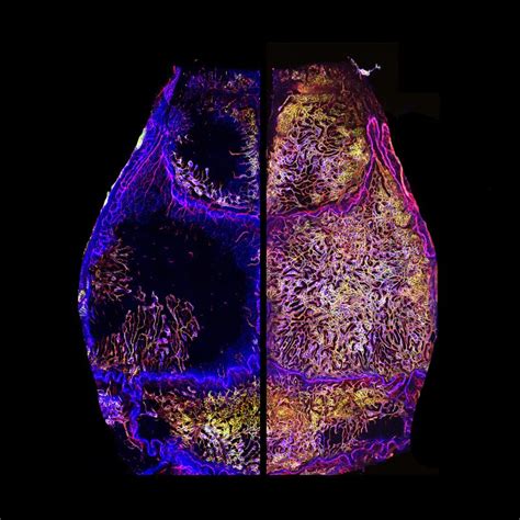 Skull Bone Marrow An Unexpected Resilient Player In Aging And Immune