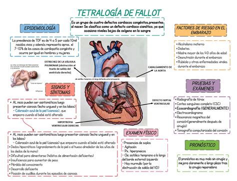 O Que Significa Tetralogia De Fallot Braincp