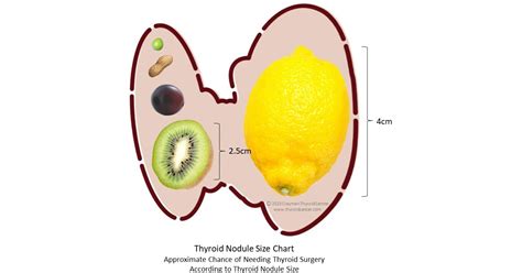 Thyroid Nodule Classification Of Ultrasound Image By, 47% OFF