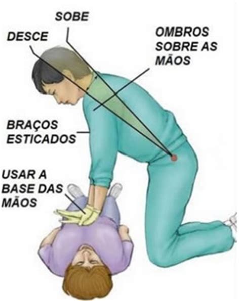 Primeiros socorros durante prática de exercício físico Cardiométodo