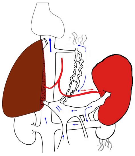 Transplantology Free Full Text Portal Hemodynamics After Living Donor Liver Transplantation