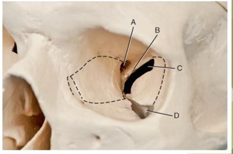 Unit Mandible Orbits Tmj Flashcards Quizlet