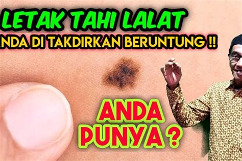 Makna Mistis Letak Tahi Lalat Yang Dianggap Berkaitan Dengan