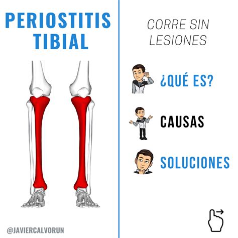 Dolor Tibia Al Correr Causas Y Soluciones Javiercalvo Run