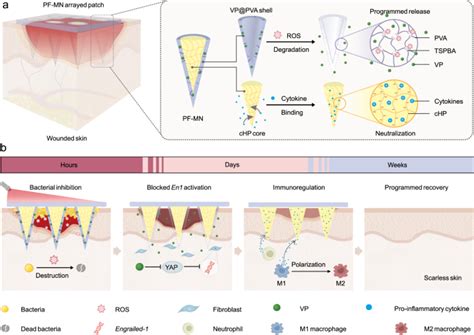 Scarless Wound Healing Programmed By Core Shell Microneedles Nature