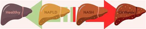 Battle of the Abbreviations: NAFLD, NASH, Cirrhosis (not an abbreviation) - ENCORE Research Group