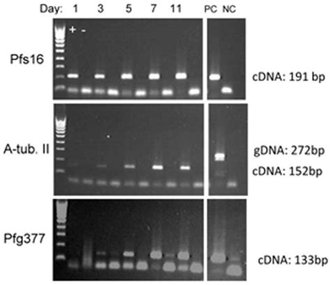 Rt Pcr Of Sexual Stage And Sex Specific Proteins During Download Scientific Diagram