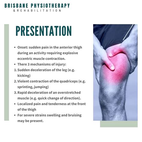 Quadricep Strain What Is It Symptoms Treatment Rehab And Physio Brisbane Physiotherapy