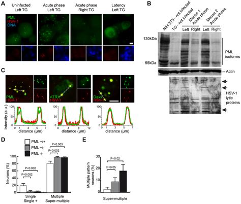 Pml Pml Nbs Control The Distribution Of Incoming And Latent Hsv