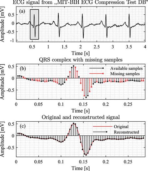 Reconstruction of a QRS complex with missing samples. a The considered... | Download Scientific ...