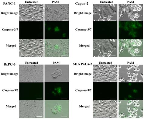 Effectiveness Of Plasma Treatment On Pancreatic Cancer Cells