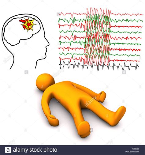 Apoplej A Fotos E Im Genes De Stock Alamy