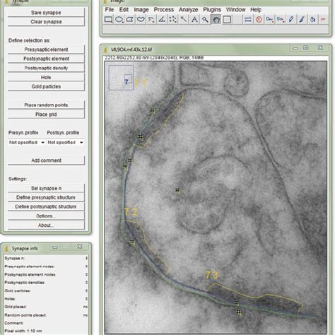 Analysis Of Double Immunogold Labeling In Axon Terminals Using Imagej