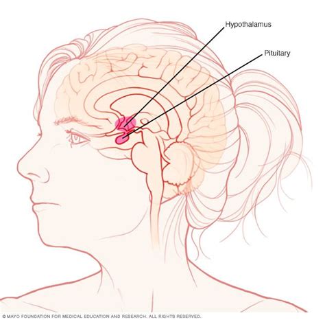 Pituitary tumors symptoms and causes – Artofit