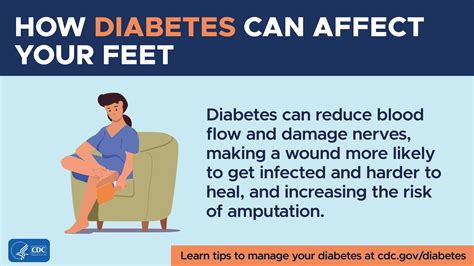 Your Feet and Diabetes | Diabetes | CDC