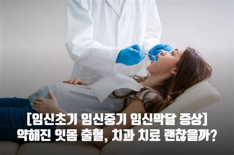 임신초기 임신중기 임신막달 증상 약해진 잇몸 출혈 치과 치료 괜찮을까 네이버 블로그