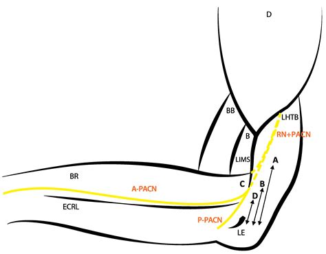 Ijerph Free Full Text The Course Of Posterior Antebrachial Cutaneous Nerve Anatomical And