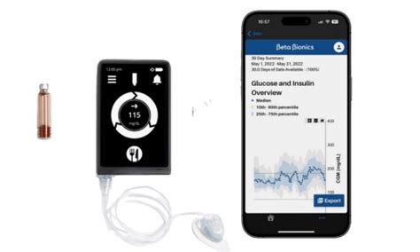 iLet Bionic Pancreas