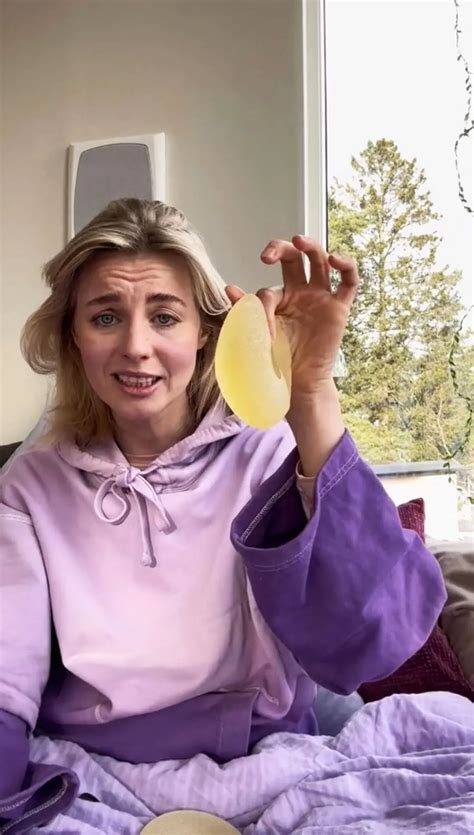 Woman's horror after breast implants 'exploded' all over her leaving