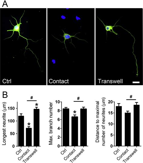 Mesenchymal Stem Cell Derived Exosomes From Different Sources