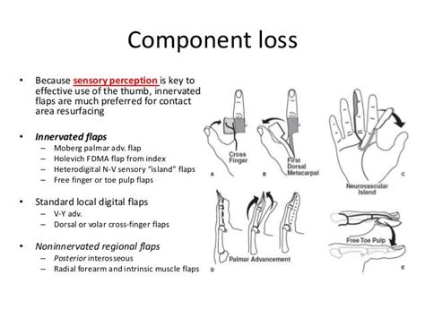 Thumb Reconstruction